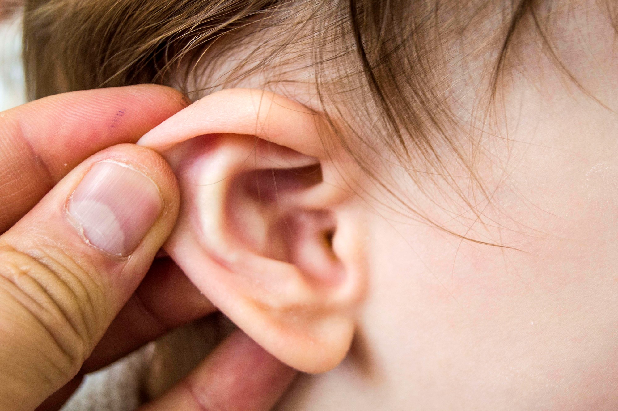 Ear Infections – a question of ideal management￼